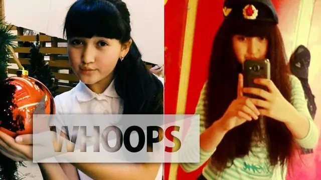 Gadis Cantik Ini Tersambar Petir Saat Menerima Telepon dengan Handphone