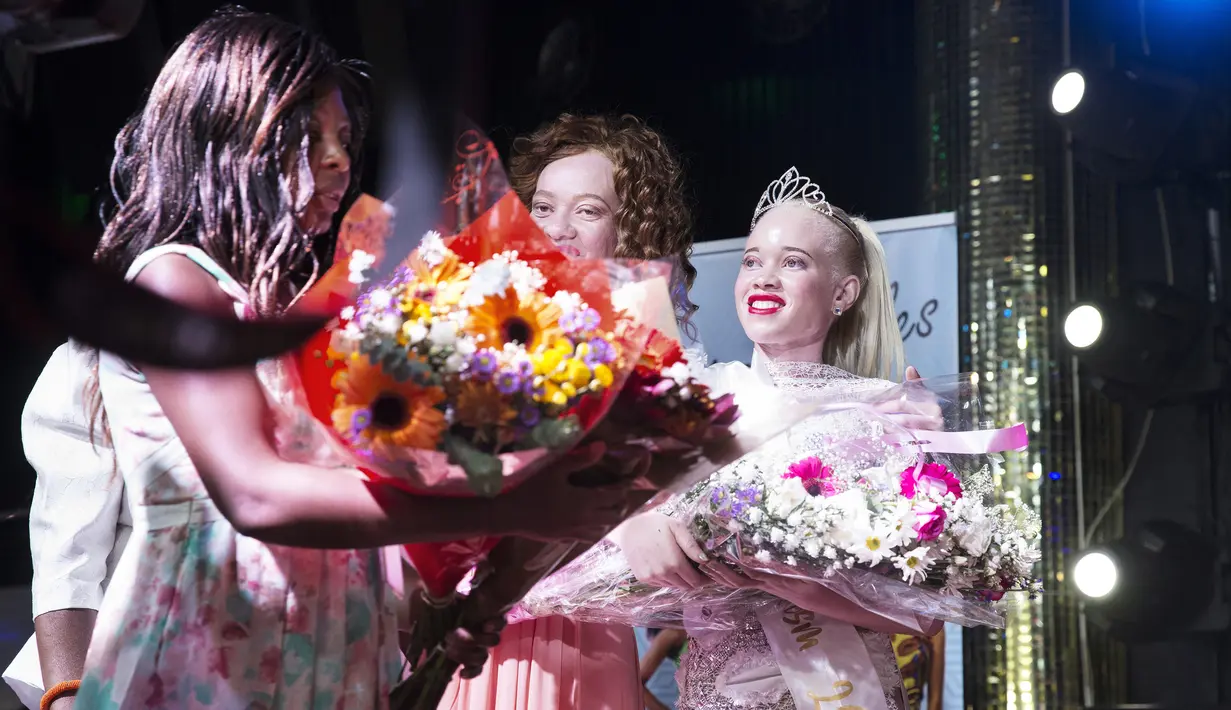 Seorang konstetan bernama Sithembiso Mutukura menerima buket bunga setelah meraih gelar Miss Albino pertama di Zimbabwe (17/3). (AFP Photo/Jekesai Njikizana)