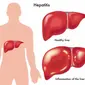 World Health Assembly disetujuinya resolusi untuk meningkatkan pencegahan, diagnosa, dan pengobatan Hepatitis. 