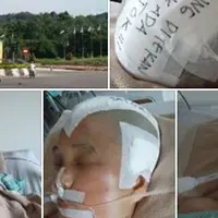 Seorang wanita diyakini dari Batam diduga menjadi korban tabrak lari polisi. Kondisinya kritis. Tempurung kepalanya hilang. 