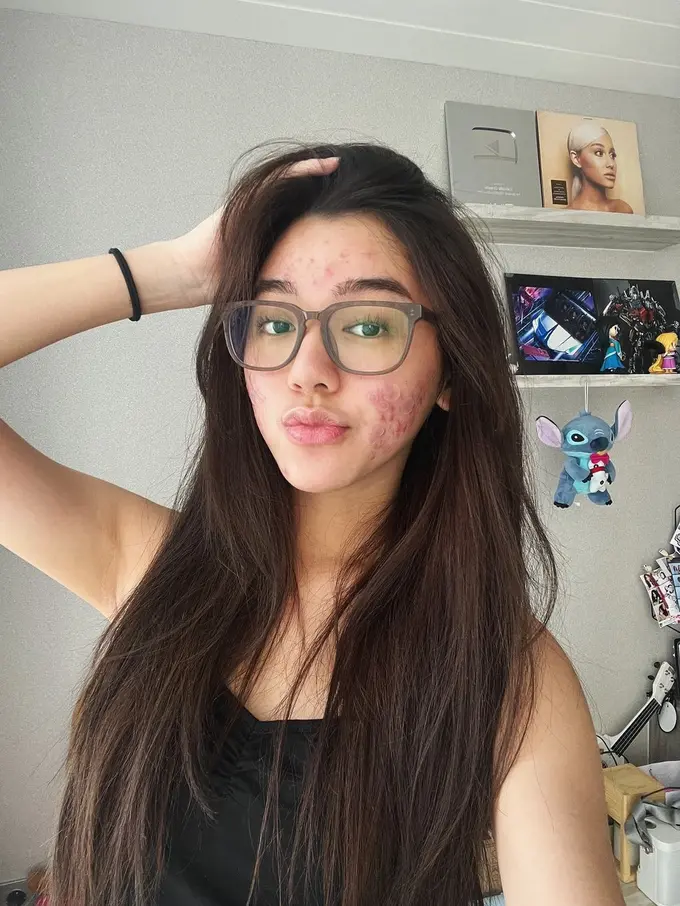 Potret Menawan Gabriella Eka Putri, Tampil Percaya Diri dengan Bare Face dan Berjerawat