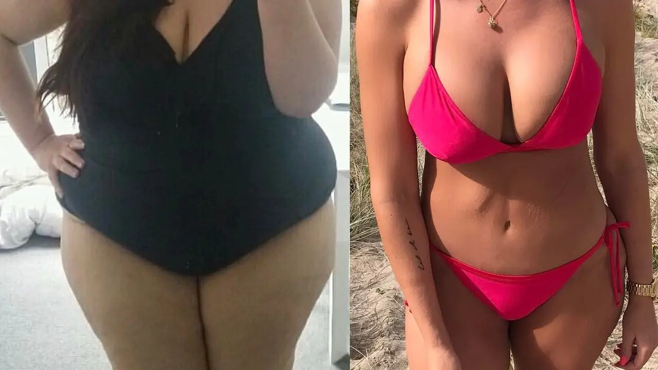 Turun 92 Kg, Ini Rahasia Diet Si Gadis Obesitas