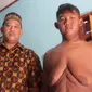 Masalah baru muncul setelah Arya si bocah obesitas asal Karawang berhasil menurunkan secara drastis berat badannya. ( Liputan6.com/ Abramena)