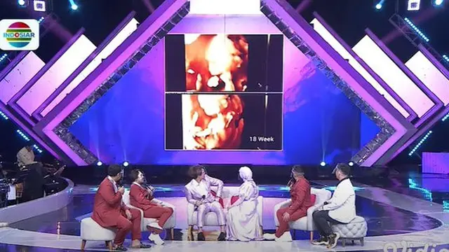 6 Potret Lesty Kejora Pamer Foto USG, Kini Usia Kandungan Sudah 6 Bulan
