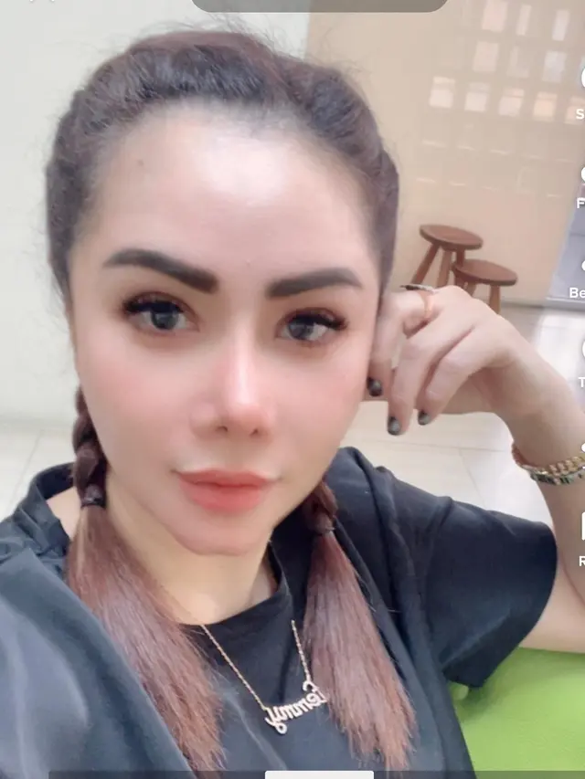 Habiskan Rp 120 Juta, Ini 6 Potret Femmy Permatasari Usai Operasi Sedot Lemak