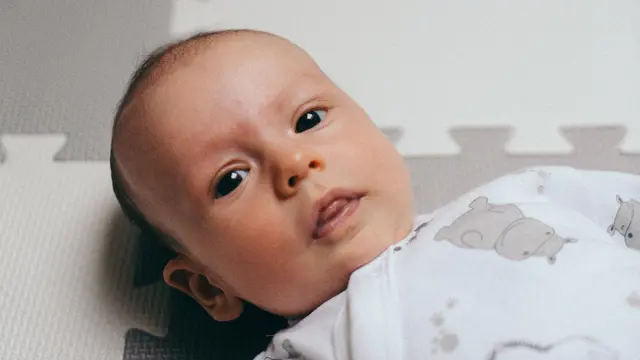 Bintik merah pada bayi