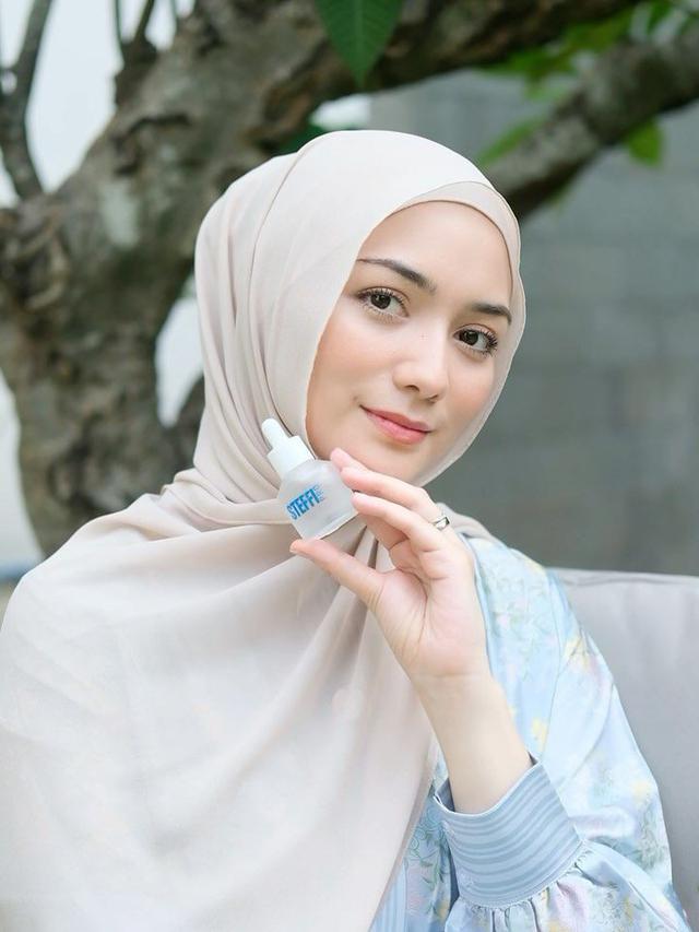 Citra Kirana. (Foto: Dok. Istimewa)