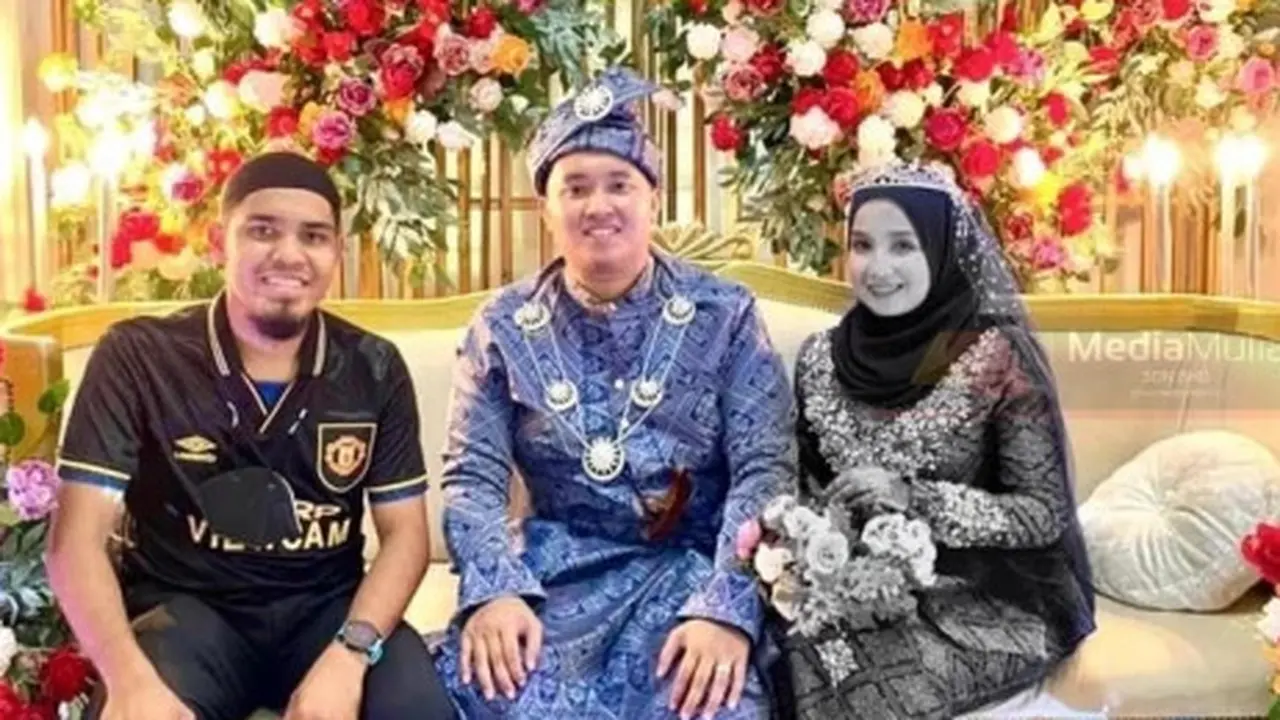 Sehari Setelah Menikah, Istri Pria Ini Meninggal Karena Pendarahan di Otak