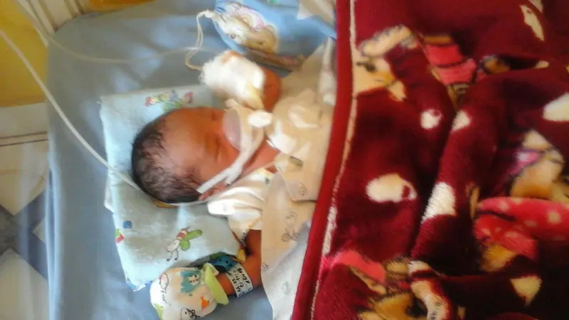 Bayi malang yang dibuang ibu kandungnya mengalami sesak nafas (Liputan6.com/Nefri Inge)