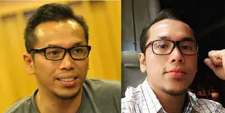 Perubahan wajah beberapa penyanyi wanita yang semakin cantik usai melakukan operasi plastik tentu sudah tak terlalu aneh lagi. Namun apa yang terjadi kalau pria yang melakukannya?. (Via Instagram/Sammy Simorangkir)