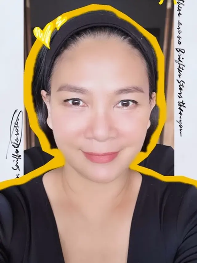 Dian Nitami lakoni oplas (Instagram/bu_deedee)