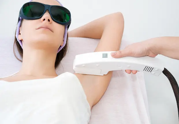 laser hair removal