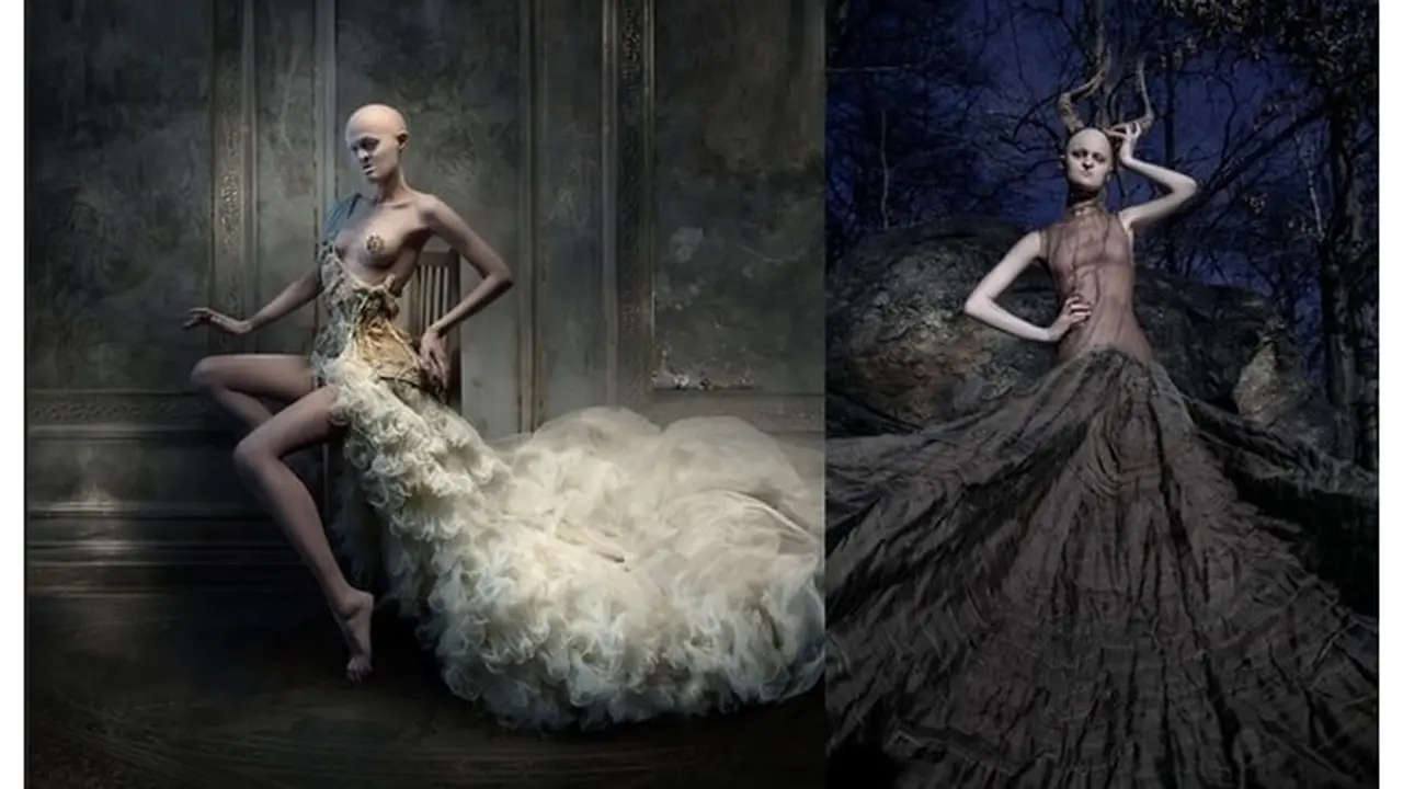 Melanie Gaydos, Model Sukses yang Menderita Kelainan Genetis