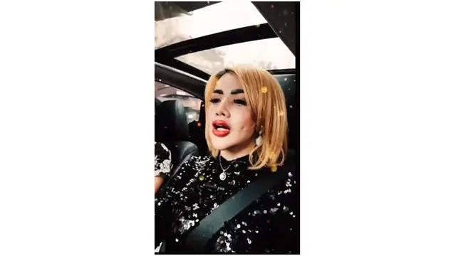 Usai sulam bibir, Barbie juga mengaku kesusahan makan lantaran efek sakit yang masih dirasakannya.