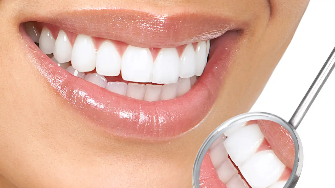 5 Lip Gloss Ajaib yang Bisa Bikin Gigi Kamu Terlihat Lebih Putih