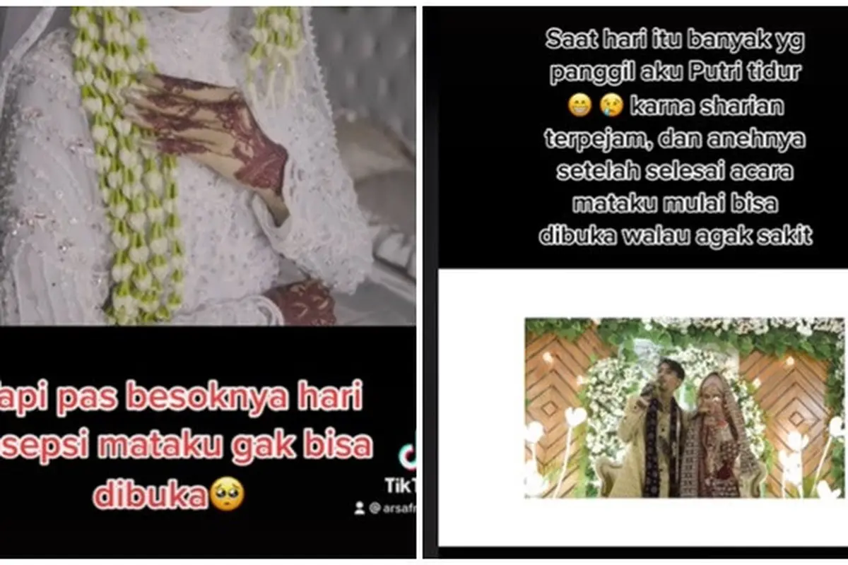 Viral Mata Pengantin Wanita Ini Tak Bisa Terbuka saat Resepsi, Diduga Disantet