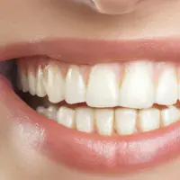 Menyikat gigi dan flossing adalah bagian penting untuk menjaga kebersihan mulut, tetapi membersihkan lidah juga memiliki peran besar yang sering diabaikan (Sumber: Pexels.com)