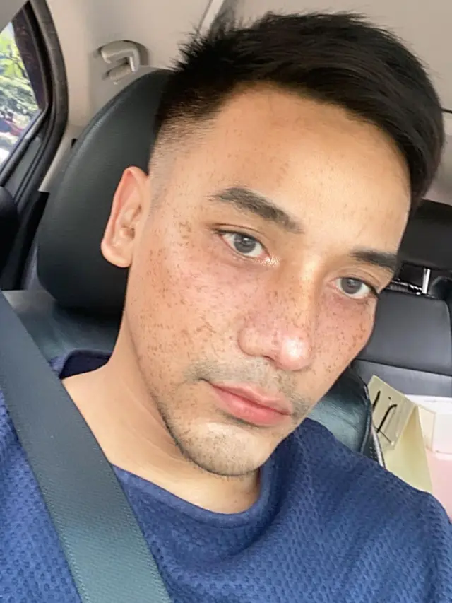 Ungkap Alasan Operasi Plastik, Ini 6 Potret Terbaru Bubah Alfian yang Bikin Pangling