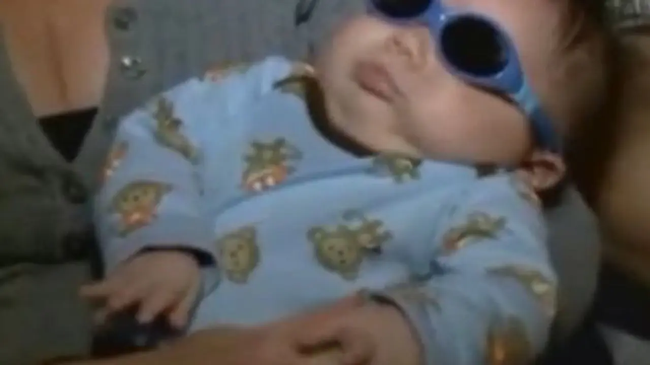 Bayi Ini Lahir Tanpa Bola Mata