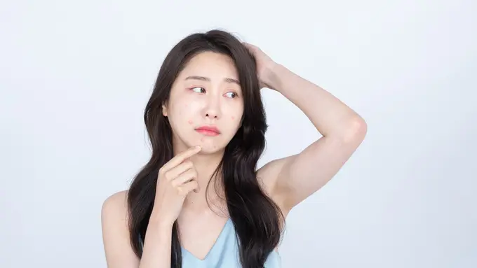 Muncul Jerawat Setelah Facial, Normal Nggak Sih? Gali Fakta dan Tips Perawatan yang Tepat