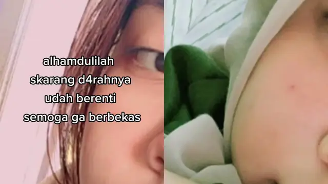 Kepanikan gadis saat membersihkan muka hingga tak sadar mengeluarkan darah.