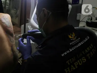 Petugas menghapus tato peserta menggunakan sinar laser di Balai Kota DKI Jakarta, Selasa (11/3/2025). (LIputan6.com/Herman Zakharia)