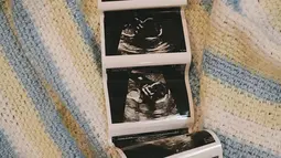 Dalam unggahan, aktris yang dikenal luas berkat perannya dalam serial Putri Duyung itu juga memamerkan foto USG kehamilannya. Bahkan, selimut yang digunakan sebagai latar belakang foto tersebut ialah hasil rajutan dari tangan Anggika sendiri. (Liputan6.com/IG/@anggikabolsterli)