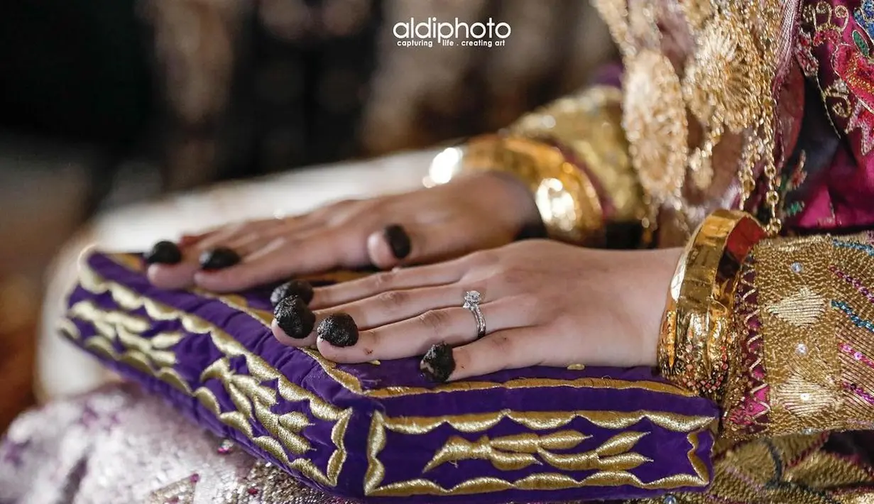Di momen pelekatan tumbukan halus daun pacar kuku di kuku Lesti Kejora juga terlihat detail aksesori tangan yang digunakannya, berupa cincin pertunangan di jari manis tangan sebelah kiri dan beberapa gelang emas yang dikenakan di kedua tangannya. Foto: Instagram @aldiphoto.