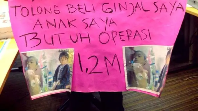 Demi Anak, Pria Ini Rela Jual Ginjal ke Jokowi