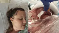 Carrie Decklyen (37) melahirkan bayinya, Life Lynn, melalui operasi darurat pada hari Rabu (06/09/17) di University Hospital, Ann Arbor (melalui operasi darurat pada hari Rabu (06/09/17) di University Hospital, Ann Arbor (facebook.com/cure4carrie)