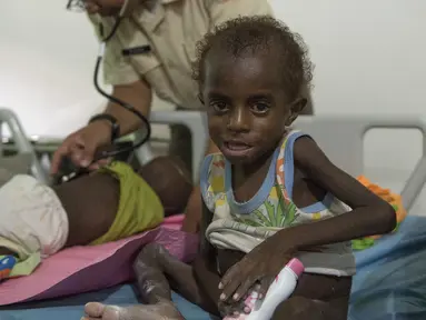 Seorang anak menjalani perawatan di rumah sakit setempat di Agats, Asmat, provinsi Papua Barat (26/1). Sebanyak 86 pasien anak gizi buruk dan campak di Kabupaten Asmat masih dirawat di Rumah Sakit Umum Daerah (RSUD) setempat. (AFP/Bay Ismoyo)