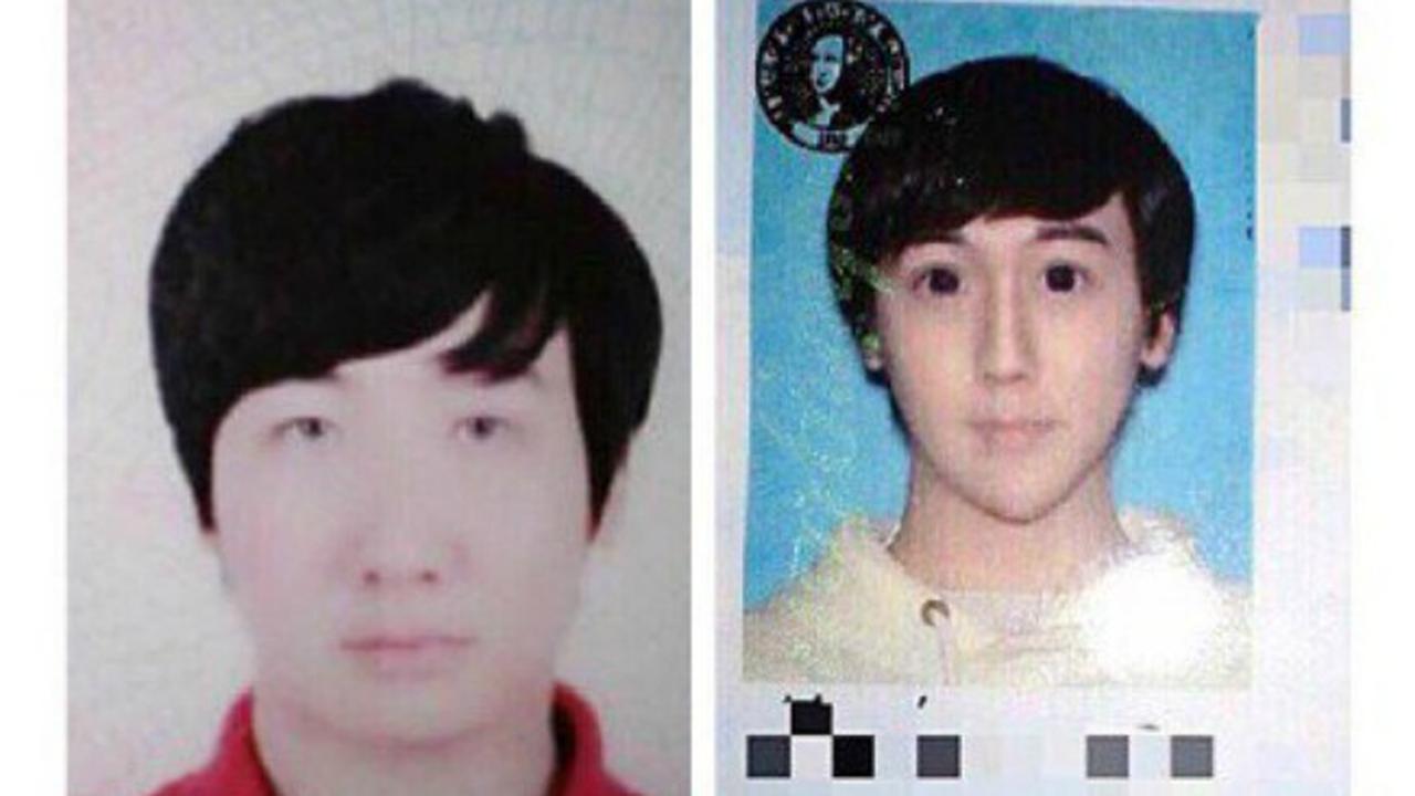  Pria Operasi Plastik Seperti 'Ular Putih' Tuai Kecaman