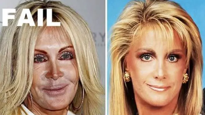 Nih, Operasi Plastik yang Lebih Seram dari Efek Beras Plastik