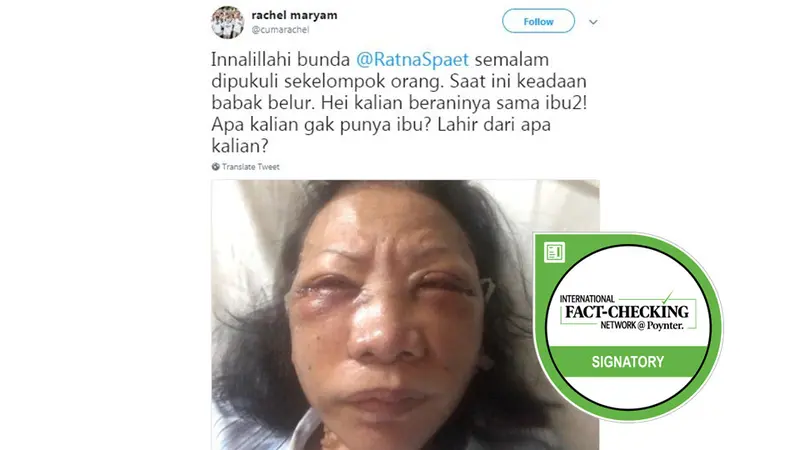 Cek Fakta - Penganiayaan Ratna Sarumpaet