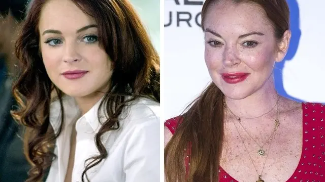 artis sebelum vs setelah operasi plastik
