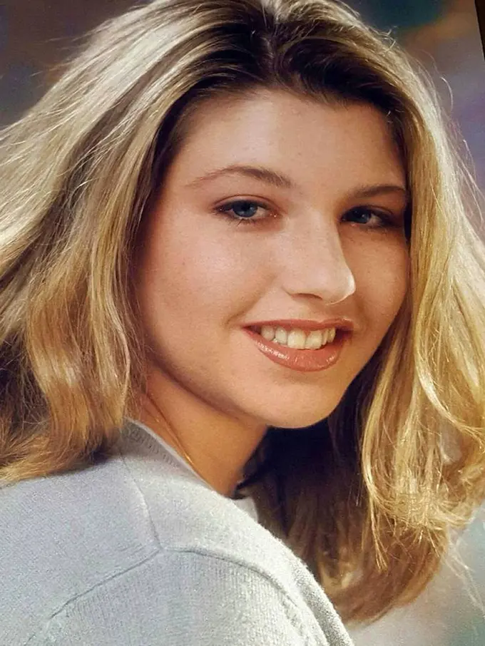 [Bintang] Karena Sang Mantan Pacar, Perempuan Ini Harus Menjalani 56 Kali Operasi