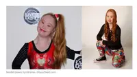 Madeline Stuart atau Mandy buktikan diri sukses jadi model di tengah kondisinya sebagai disabilitas down syndrome. (Merdeka.com)