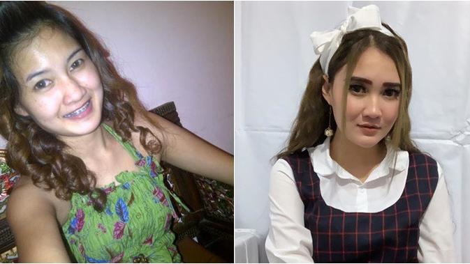 Nella Kharisma dulu dan kini (Sumber: Instagram/nellakharisma)