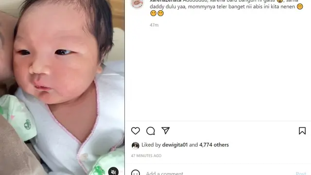 Siti Badriah (Foto: Instagram/@xarenazenata)