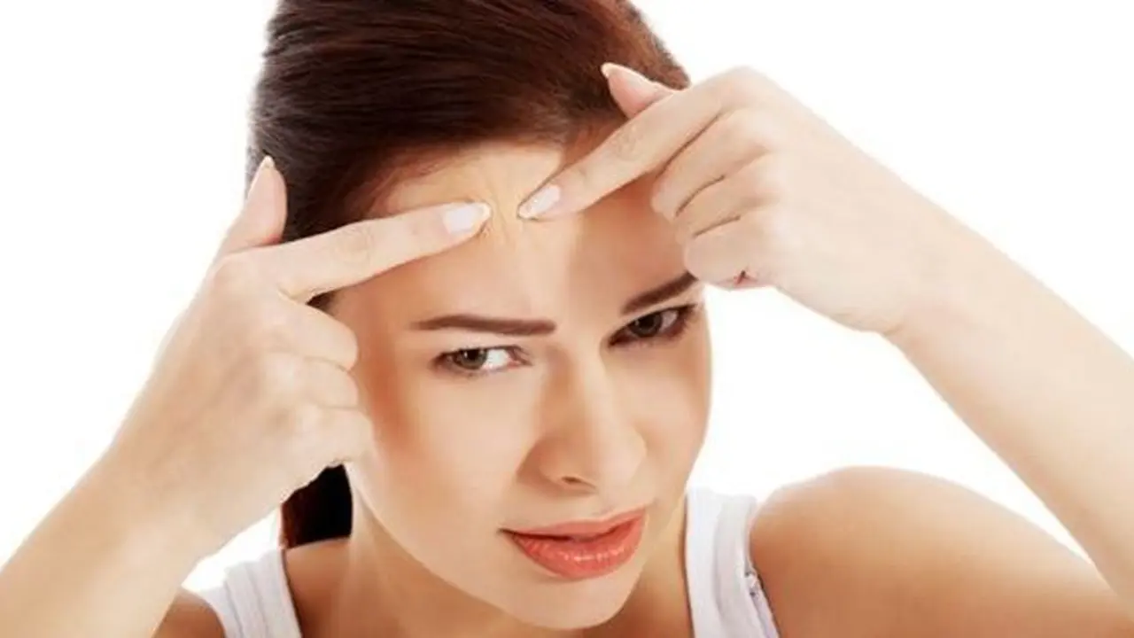 Jerawat/Copyright Shutterstock