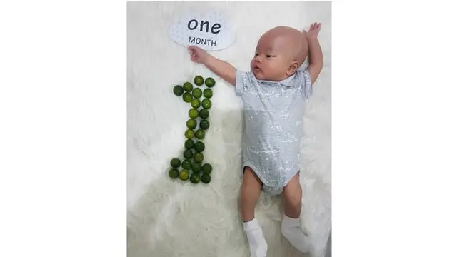 Tepat di usianya yang satu bulan ini, baby Zain sudah melakukan prosesi khitan.