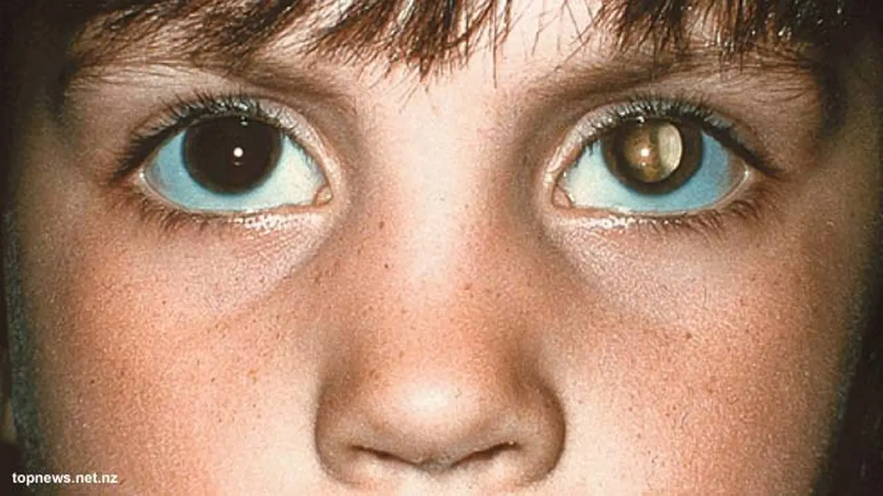 retinoblasma-130704b.jpg