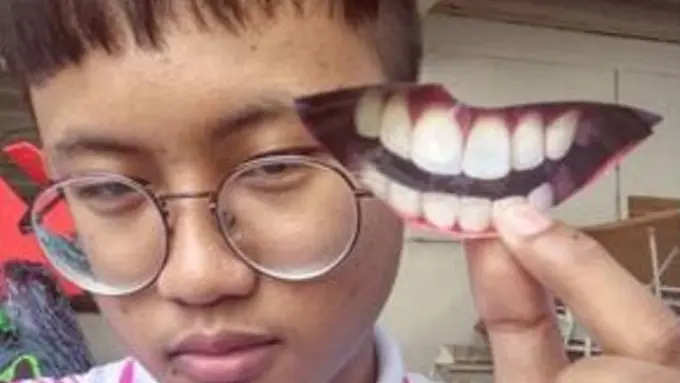 Tak Punya Uang ke Dokter Gigi? Atasi Pakai Bungkus Keripik!