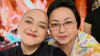 Cukur Habis Rambut, Lizzie Parra Dikelilingi Orang Tersayang di Tengah Perjuangan Lawan Kanker