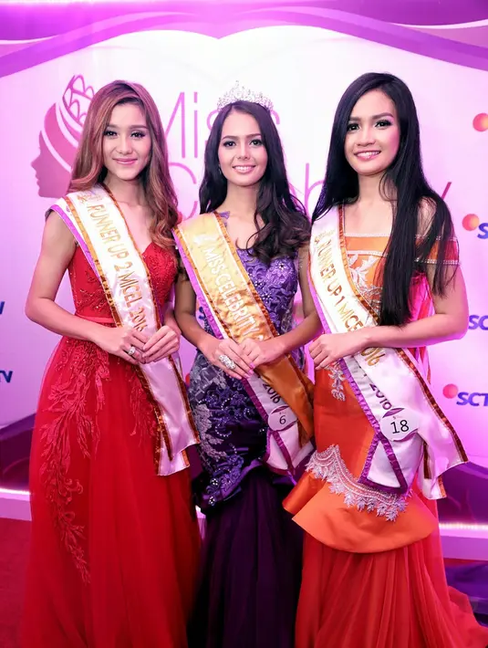 Harapan ke depannya, peluang karier didunia hiburan Tanah Air semakin terbuka lebar. Sebagai bagian dari keluarga besar SCTV, ia siap bertanggung jawab dengan apapun yang diberikan padanya. (Adrian Putra/Bintang.com)