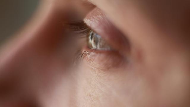 Ilustrasi gangguan mata, mata kering