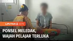 Seorang pelajar menderita luka bakar di wajah dan matanya tidak dapat melihat dengan jelas, setelah terkena ledakan ponsel di sekolah. Saat itu korban hendak menyalakan ponsel usai diisi baterai.