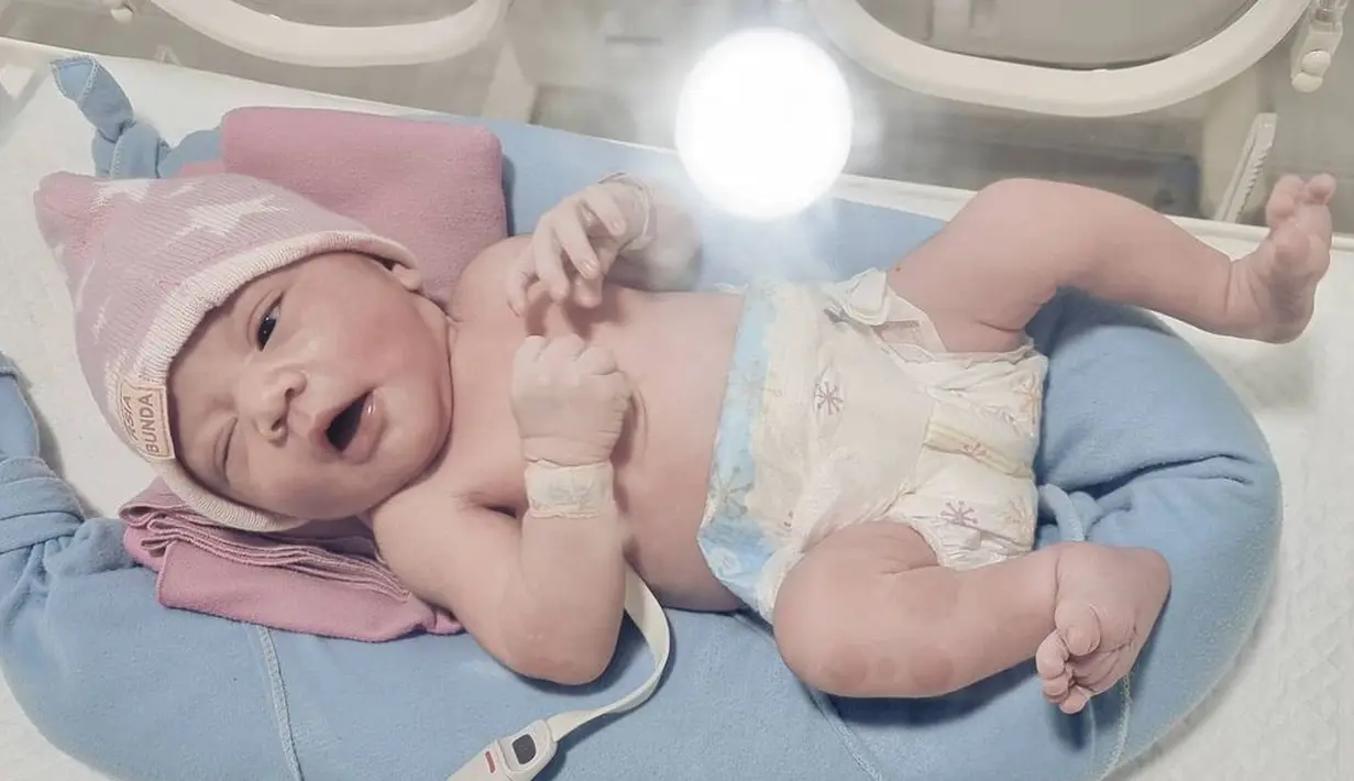 Sebagai suami, Randy terus mendampingi sang istri selama proses tersebut. Ia pun menjadi saksi perjuangan seorang ibu kala itu. Berawal dari rencana persalinan secara normal, namun karena ada kendala akhirnya diputuskan untuk tindakan cesar. (Instagram/randpunk)