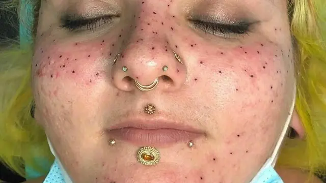 8 Potret Tato Gagal Estetik Ini Bikin Menyesal saat Membuatnya