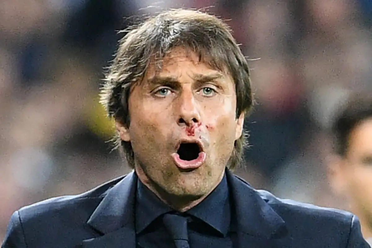 Antonio Conte